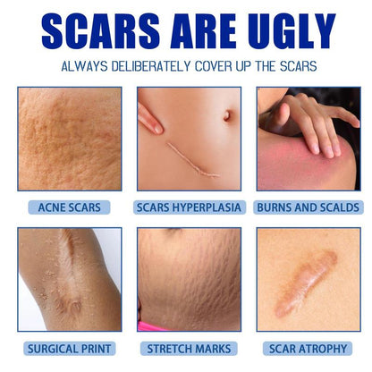 Professional Scar Removal Gel- Scarremoval Treatment for Keloids, C-Sections, Surgeries, Burns, Acne Andmore.
